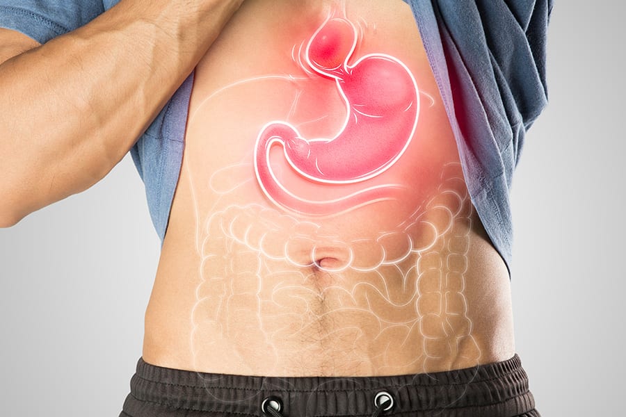 comment soigner hernie hiatale cause operation rgo traitement docteur yann assaf chirurgie parietale paris