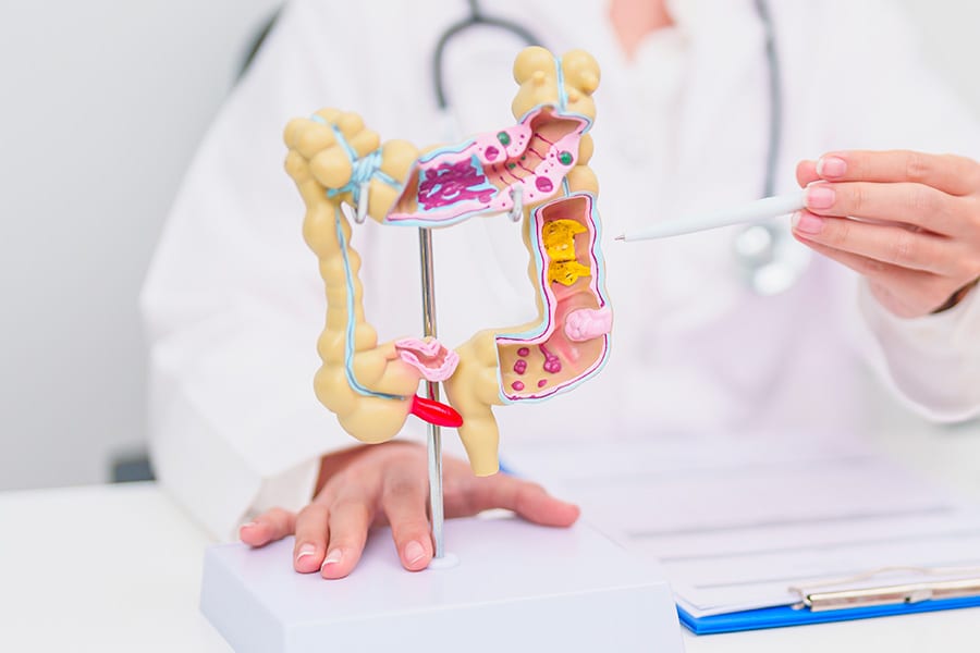 diverticulose du colon traitement diverticules docteur yann assaf chirurgie parietale paris