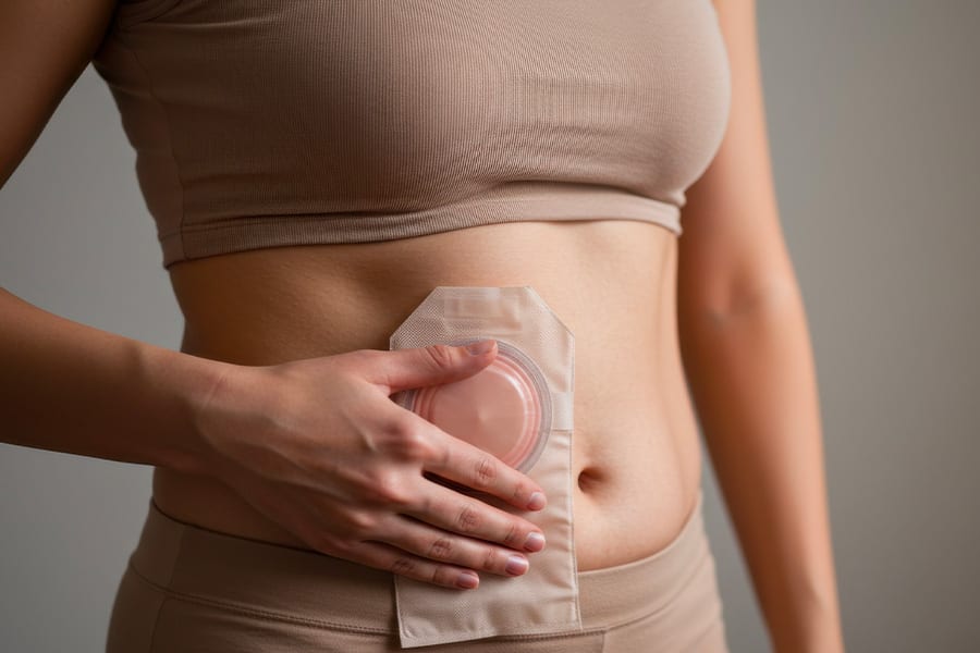 chirurgie cancerologique oncologie chirurgicale docteur yann assaf oncologie digestive paris