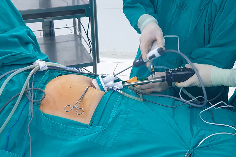 chirurgie monotrocart chirurgie mini invasive docteur yann assaf chirurgie viscerale digestive paris