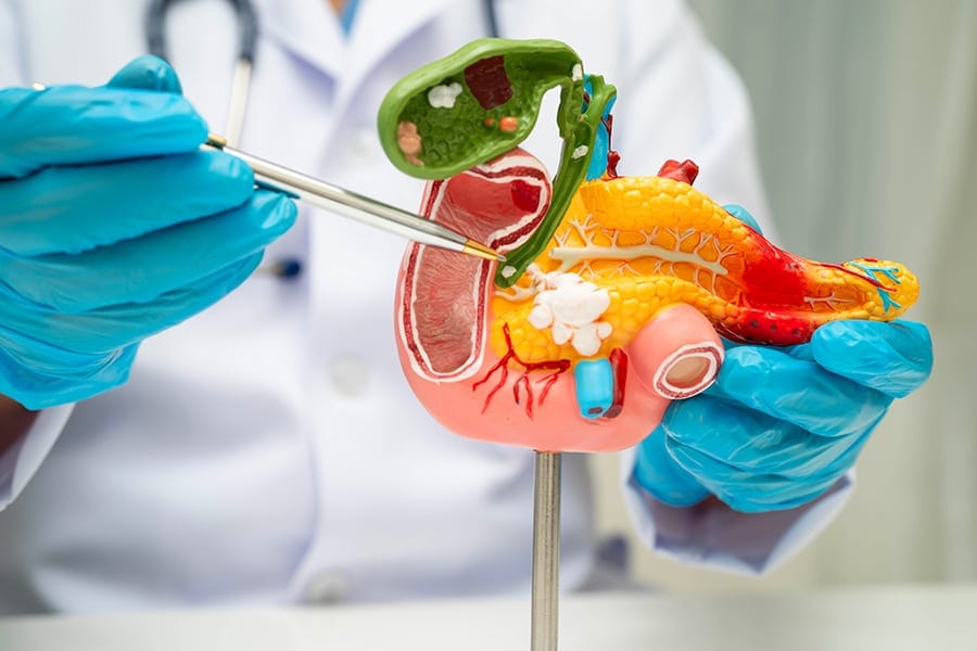 tumeur des voies biliaires oncologie chirurgicale docteur yann assaf oncologie digestive paris