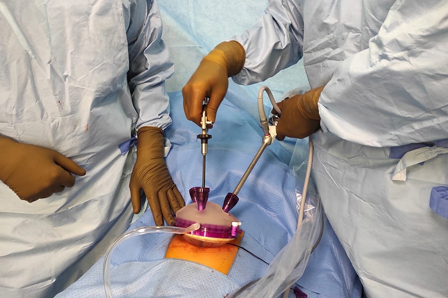 chirurgie monotrocart sils docteur yann assaf chirurgien visceral et digestif chirurgie parietale de l obesite paris