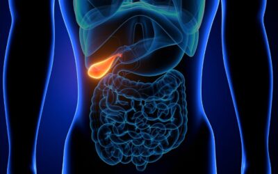Ablation vésicule biliaire : quelles conséquences à long terme ?